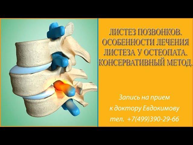 Листез позвонков. Особенности лечения листеза у остеопата. Консервативный метод. Доктор Евдокимов