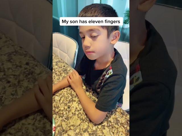 MY SON HAS 11 FINGERS!!