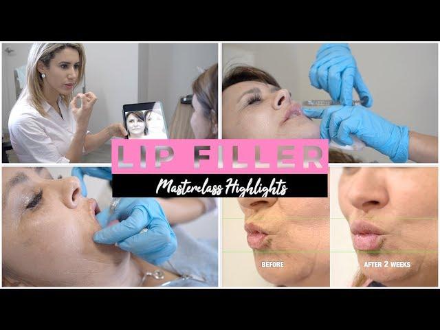 Advanced Lip Filler Techniques Tutorial with Dr Nora | Highlights