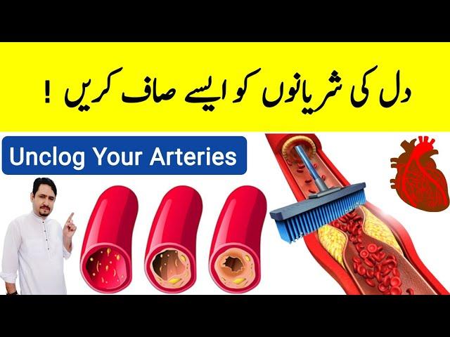 Best Remedy To Unclog Your Arteries - Irfan Azeem