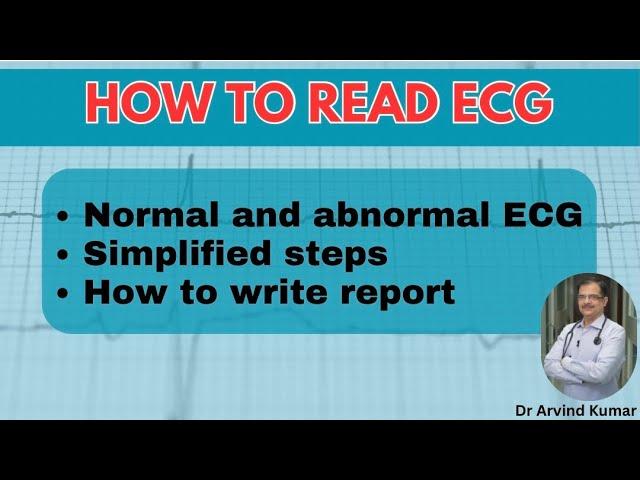 Mastering ECG Reading || Simplified Guide for Interns, General Practitioners, and Medicine Residents