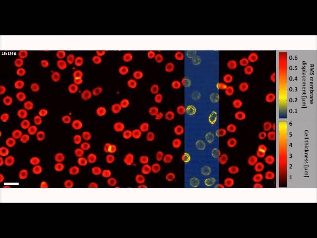 Fast phase processing in off-axis holography using multiplexing with complex encoding...