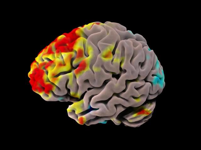 fMRI Data Visualization