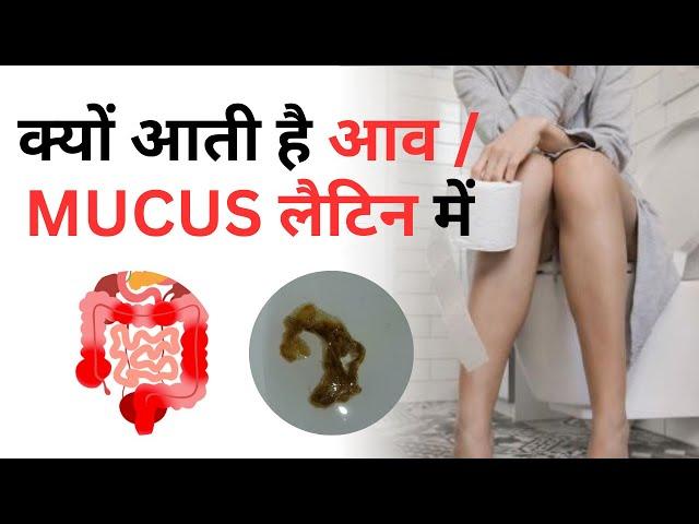 क्यों आता है आपके मल मे आव (म्यूकस) ! Mucus in stool | #drzubindevshrma #mucusinstool #mucus #stool