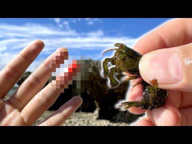 Mantis shrimp destroying human fingers!