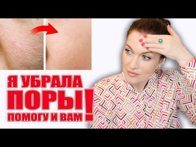 Убрала расширенные поры! Помогу и вам! Работающие решения, никакой "воды"!