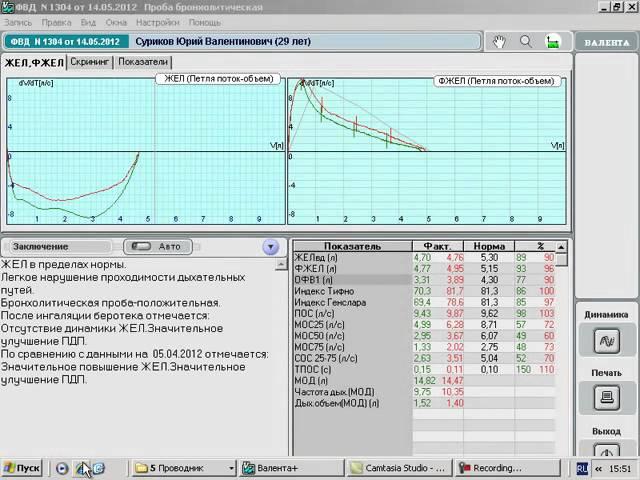 Исследование спирометрии с функц пробами бронхолит