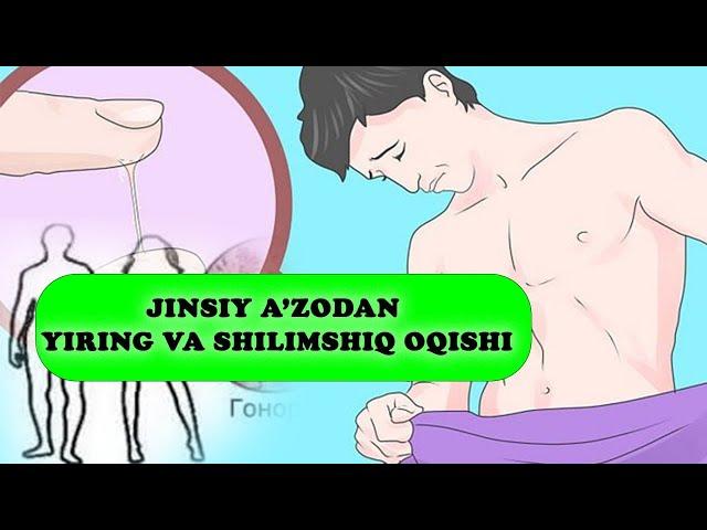 Jinsiy a’zodan yiring va shilimshiq oqishi | Dr.Azizbek