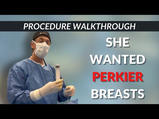 Saline implants breast augmentation with a lift | Dr 6ix | Six Surgery | Toronto