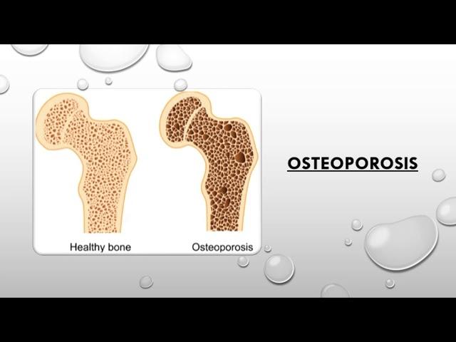 Anatomy and Physiology BTEC SPORT Level 3 UNIT 1- factors affecting the skeletal system