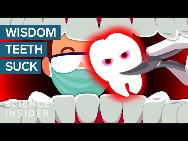 Why Do Wisdom Teeth Suck?
