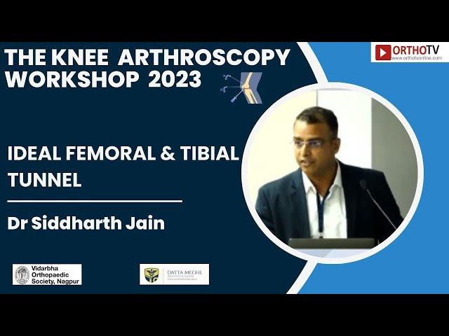 IDEAL FEMORAL & TIBIAL TUNNEL : Dr Siddharth Jain