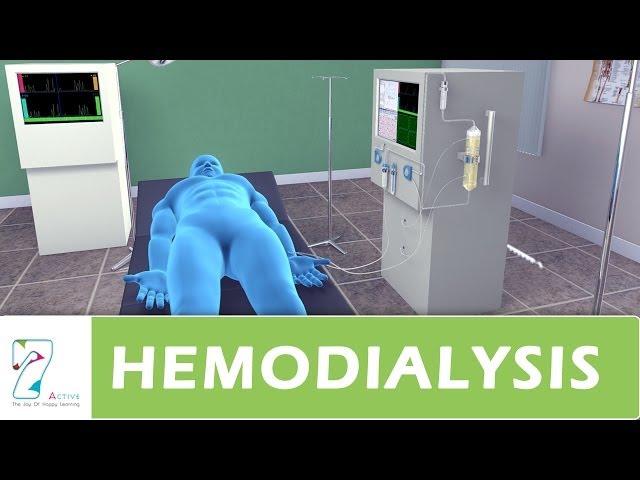 Hemodialysis