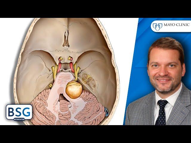 Rethinking Vestibular Schwannoma