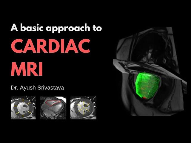 A basic approach to Cardiac MRI | Dr. Ayush Srivastava | Radiology Counsellors