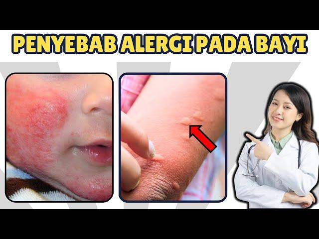 Kenali Penyebab Alergi pada Bayi dan Tips Mencegahnya
