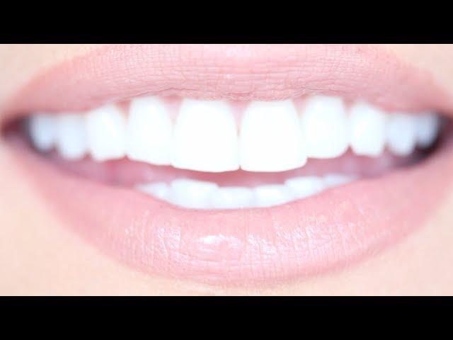 How to Get Really White Teeth For Cheap | Kandee Johnson