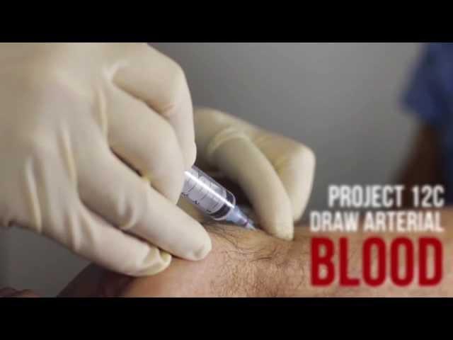 Draw Arterial Blood from the Radial Artery