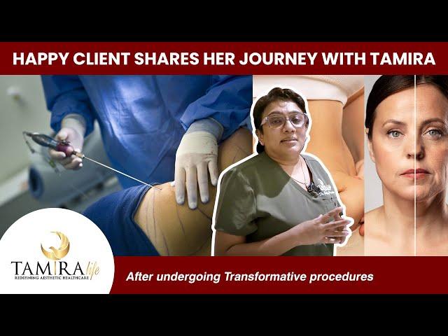 Success with TamiraLife: Client's Inspiring Story after Liposuction Treatment