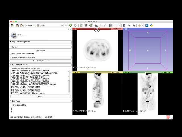 PET DICOM extension (2017)