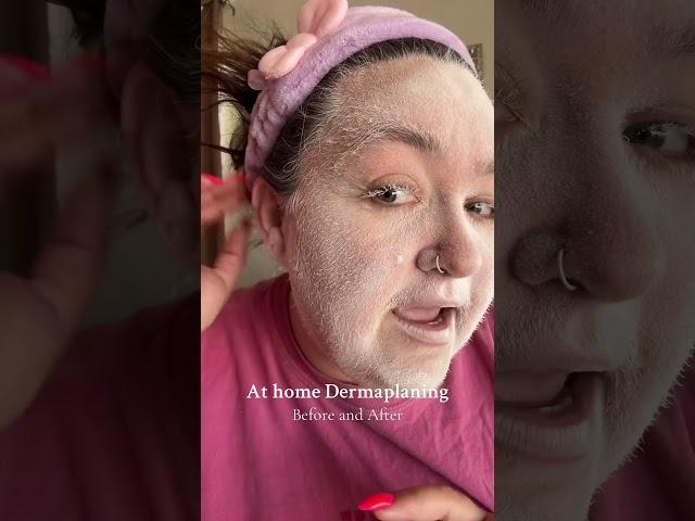 At home dermaplaning before and after! #skincare #dermaplane #viral #viralproducts #viralproduct