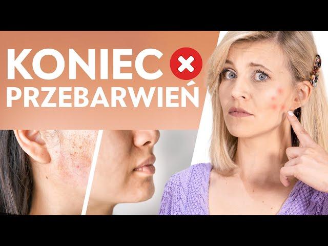 PRZEBARWIENIA - Jak się ich pozbyć?