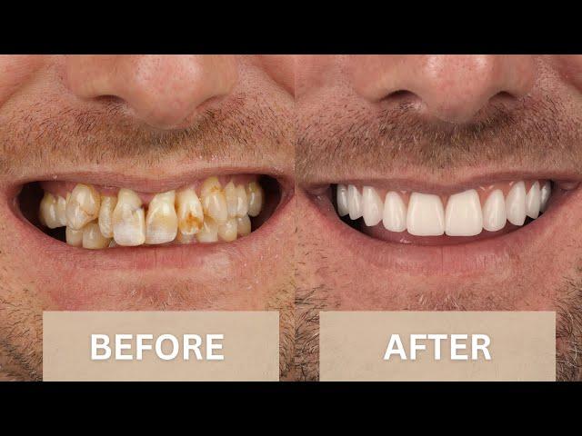 Before & After Smile Makeover Transformations | Dental Boutique™