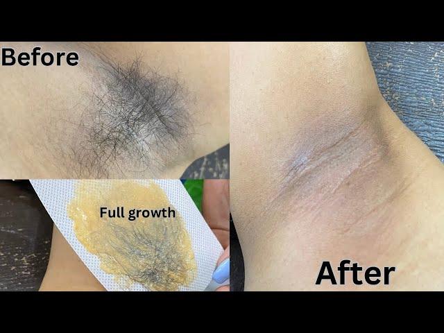 Fully growth underarm waxing || Full Tutorial vedio  Rica Wax  ⬆️