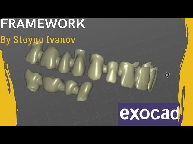 Upper Jaw and Lower Bridge Framework in EXOCAD