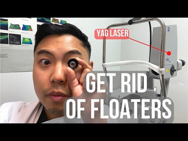 How to get rid of floaters in 2 MINUTES. (BUT IS IT SAFE?) | Ophthalmologist @MichaelRChuaMD