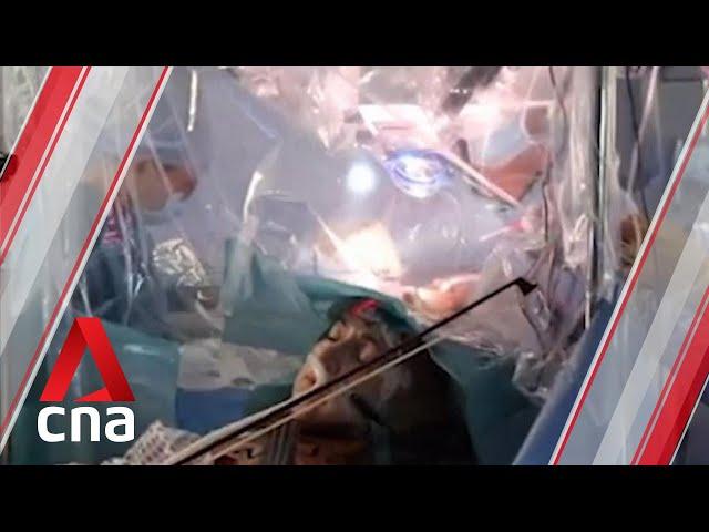 British woman plays violin while undergoing brain surgery