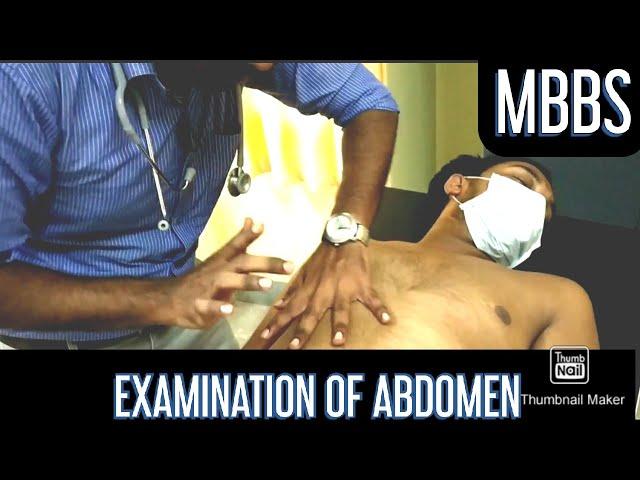 Examination of Abdomen (Full), MUHS pattern, English/Hindi, Fluid thrill, Shifting Dullness,#MBBS