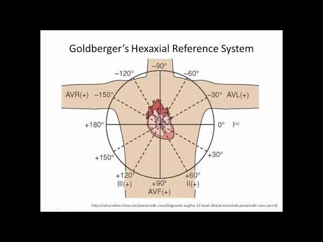 Introduction to ECGs