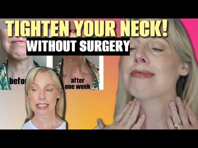 TIGHTEN YOUR NECK- WITHOUT SURGERY- in 4 steps