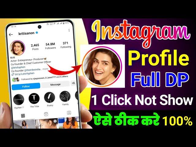 instagram profile zoom not working Problem || How to zoom not working instagram DP