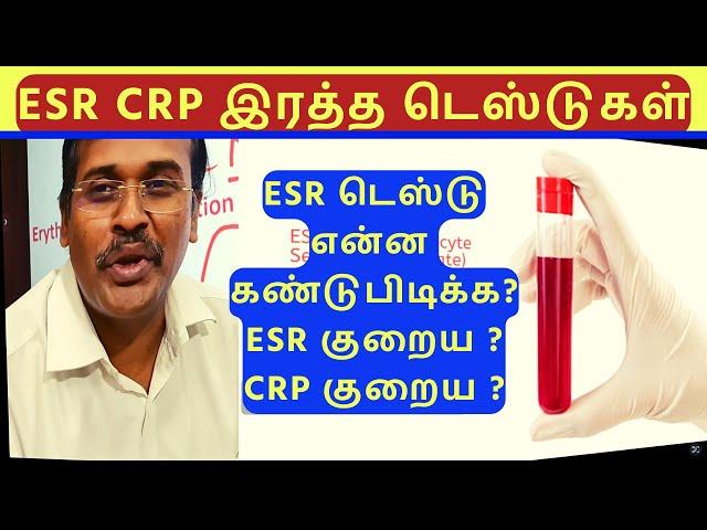 ESR vs. CRP: Blood Tests for Detecting Inflammation/வீக்கத்தைக் கண்டறிவதற்கான இரத்த பரிசோதனைகள்