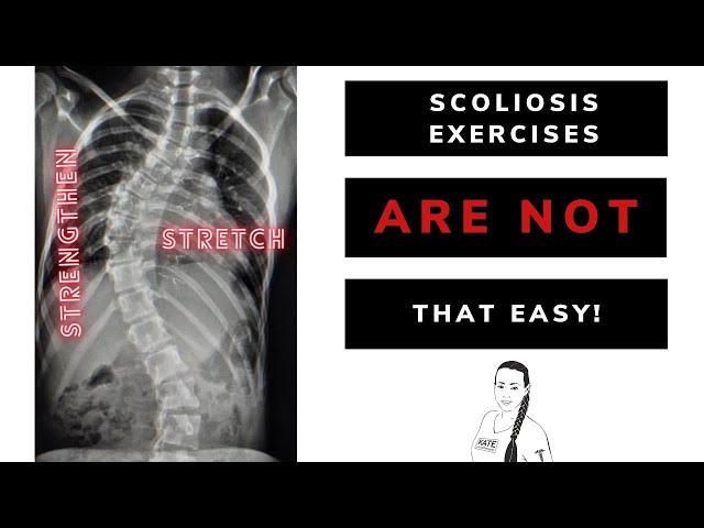 The truth about scoliosis exercises: what others won't tell You