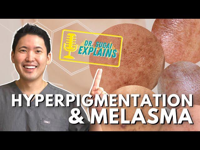 Dermatologist Explains: Hyperpigmentation and Melasma - How to Manage it with Top Picks