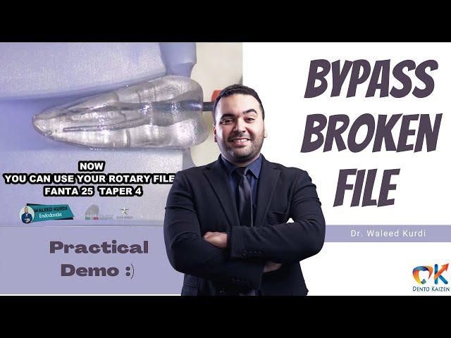 Demo | How to bypass a broken file? | Dr. Waleed Kurdi