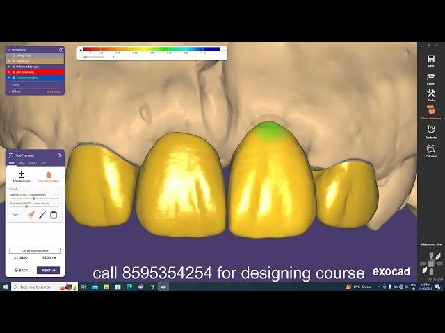 Exocad Video Tutorial/How to Design in EXOCAD? Anterior Teeth/in hindi