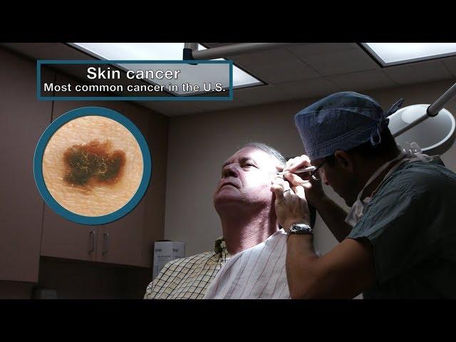 Mayo Clinic Minute: 3 Types of skin cancer