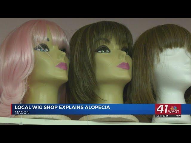 Macon wig shop explains Alopecia