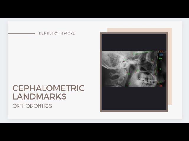 CEPHALOMETRIC LANDMARKS