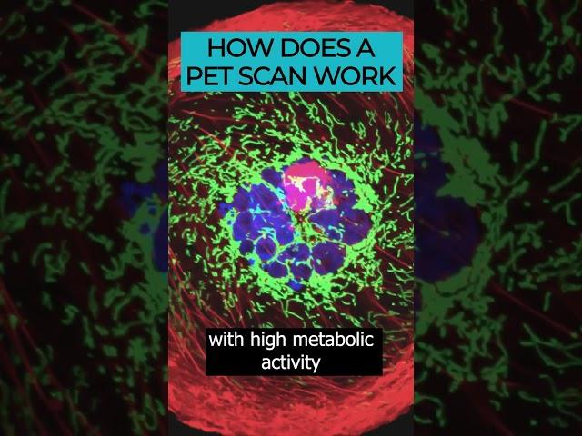 PET Scans: An advanced imaging tool for detecting cancer ️