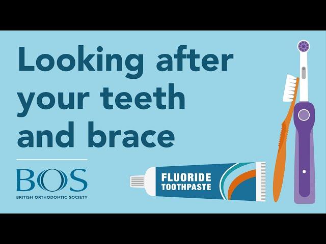 Looking After Your Teeth and Brace: Top Tips | Cleaning | Foods to Avoid | Breakages