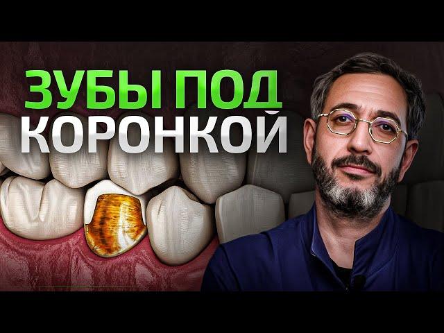 Болит ЗУБ под КОРОНКОЙ — что делать? Отвечает врач высшей категории