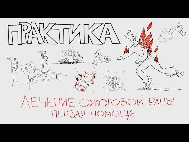 Лечение ожоговой раны - первая помощь