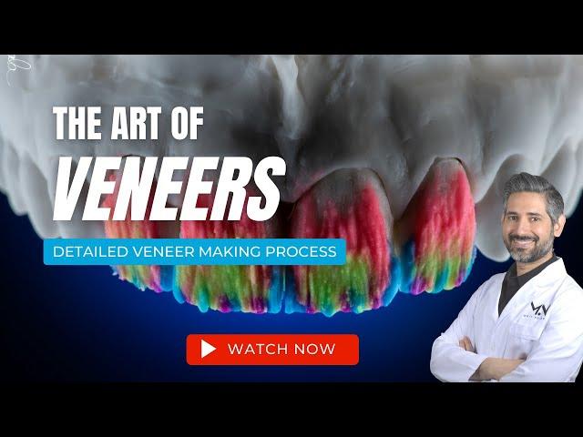 Making Porcelain Veneers | The Art of Veneers