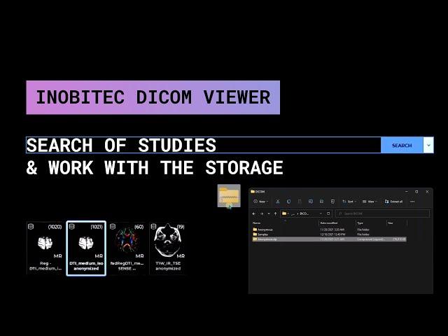 The search of studies and work with the storage with Inobitec DICOM Viewer