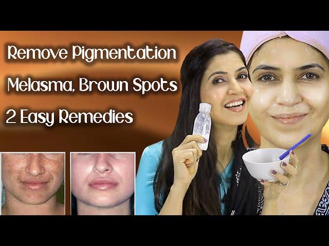 Remove Pigmentation, Melasma, Freckles, Brown Spots / Results In One Week - Ghazal Siddique